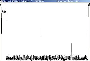 Densitometer Gamma Profile